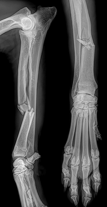 Cas Clinique Fracture Du Radius Orthovet Thierry Boulet